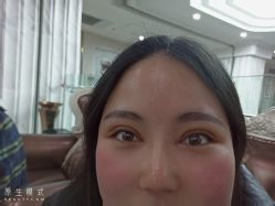 -西安壹加壹医疗美容·西北抗衰旗舰店