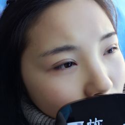 点击看大图 -西施无菌半永久纹绣眉眼影唇轻增发纹发际线