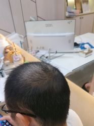 点击看大图 -碧莲盛·不剃发植发