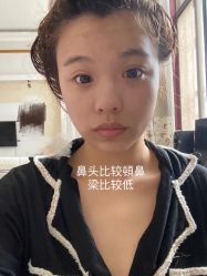 体验前-Dr.U博士医疗美容医院