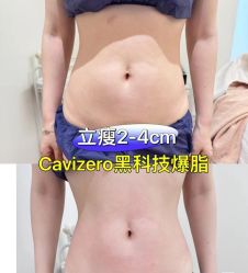 -Fundi张玉珊修身堂·indiba·BTL科技瘦身