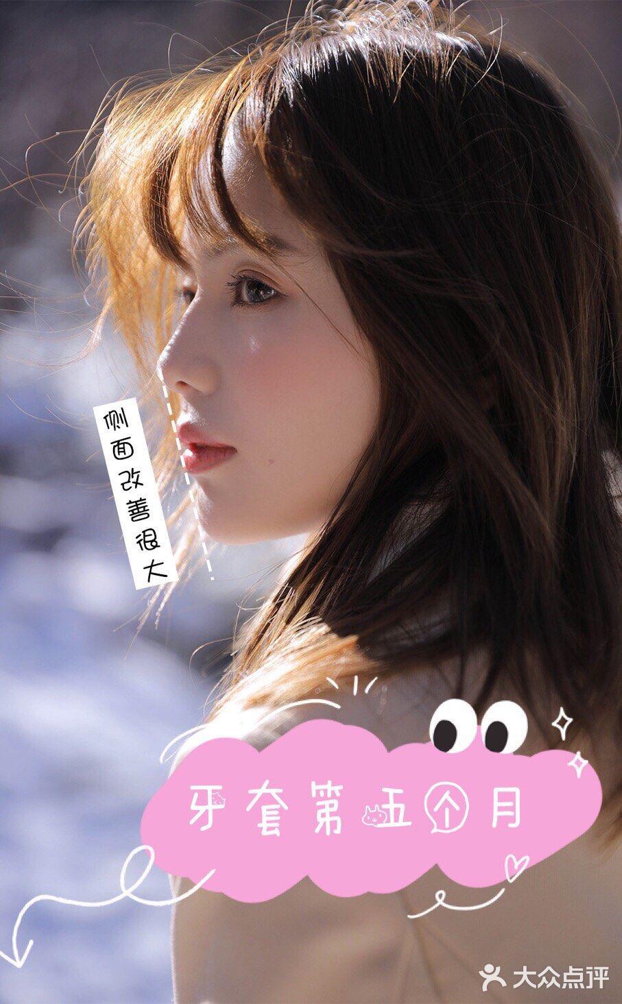 牙齿矫正案例 虎牙小美女逆袭日记
