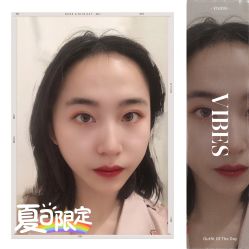 -大麦微针植发全国连锁