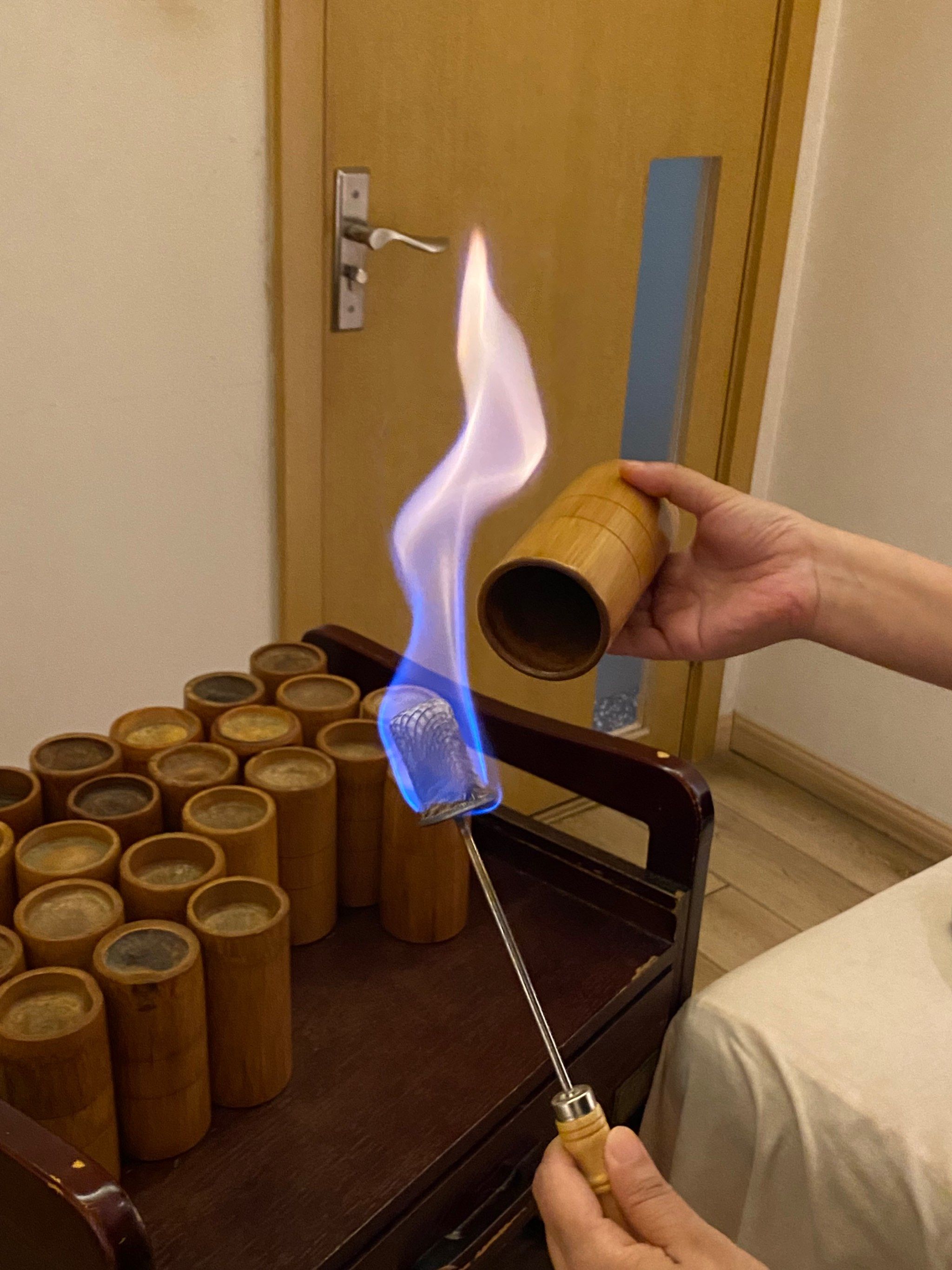 今天尝试了中医按摩👀最后还体验了拔罐,听说这两者结合,对于身体的