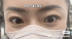 体验前-沈阳名流美容医院