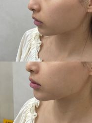 -Yestar艺星整形美容医院