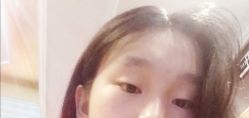 体验前-重庆军美医疗美容医院