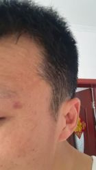 -北京美痣堂古方祛痣斑疣瘊