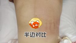 -Lily纤美·科技减脂中心