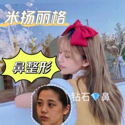 -北京米扬丽格医疗美容·联合丽格鼻整形中心