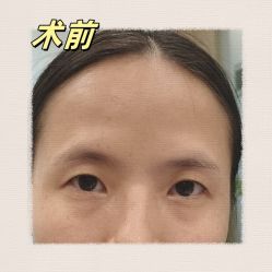 -素美医疗美容·西南眼鼻整形·修复基地