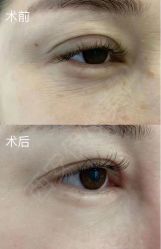 体验后-西安伊美尔医疗美容医院