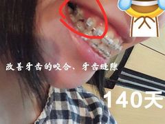 -团圆口腔·种植中心(锦江院区)