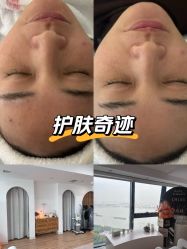 -ANNIL安奈尔·NASX超透白·科技抗衰·问题性肌肤管理