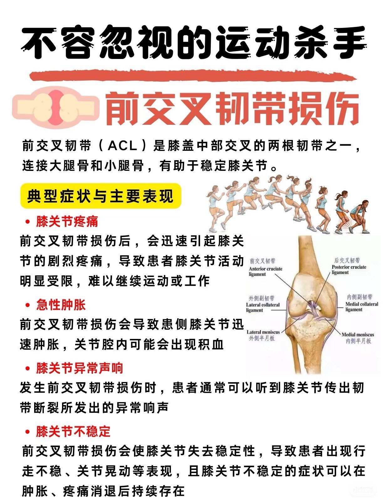 前交叉韧带损伤