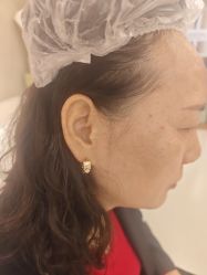 -长沙雅美医疗美容医院
