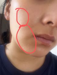 体验后-上海玫瑰医疗美容医院