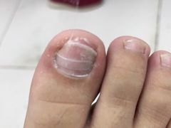 -新甲连锁灰指甲·甲沟炎·鸡眼(黑龙江路店)