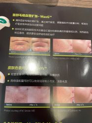 点击看大图 -丽美妍医疗美容·皮秒·立体分层抗衰