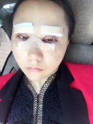 点击看大图 体验后-鑫元辰医疗美容整形