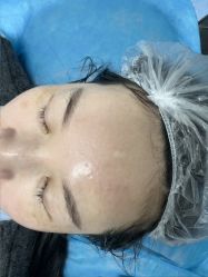 -长沙雅美医疗美容医院
