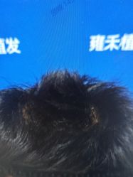 -雍禾植发全国连锁