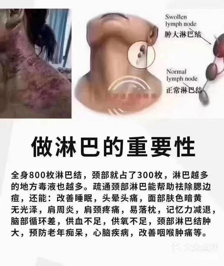 淋巴淤堵的危害你占了哪些