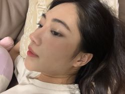 体验后-广州美莱医疗美容医院
