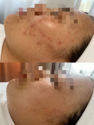-康美贞·痘肌养护管理中心
