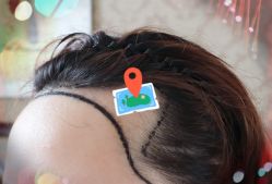 -大麦微针植发全国连锁