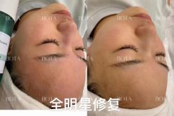 -LUNA皮相美·骨相美高级美感