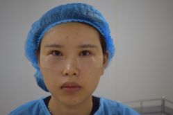 -天津健丽·去眼袋医疗美容机构