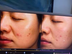 -苑苑vbeauty科技美容SPA