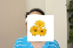 -大麦微针植发丨全国连锁