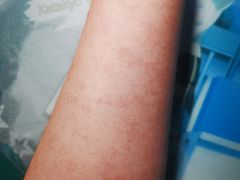 -上海市长宁区天山中医医院