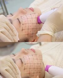 -上海漾颜医疗美容