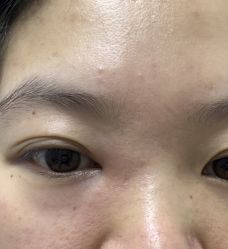 -上海玫瑰医疗美容医院