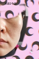 -小忠丽格医美
