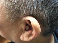 -北京悦听品牌助听器集合店峰力奥迪康斯达克瑞声达(石景山店)