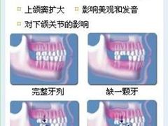 -团圆口腔·种植中心(锦江院区)