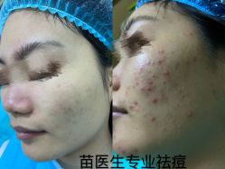 -苗医生专业祛痘·皮肤管理
