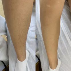 -中科妍美专业脱毛美肤连锁机构
