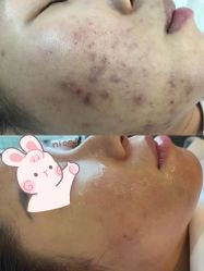 点击看大图 -SKIN79皮肤管理中心