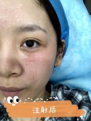 -安徽合肥韩美整形外科医院