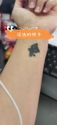 -一次性洗纹身·修复疤痕·超皮秒