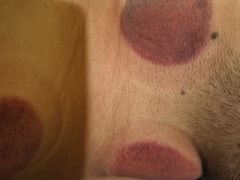 -三承堂经络·艾灸养生馆