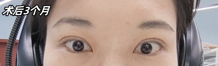 -素美医疗美容·西南眼鼻整形·修复基地