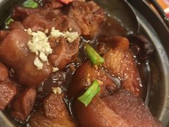 -宋小谨(惠安禹洲店)