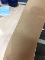 -倩极·精研痘敏肌管理
