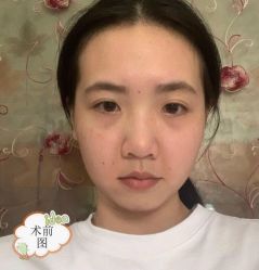 -广东韩妃整形外科医院